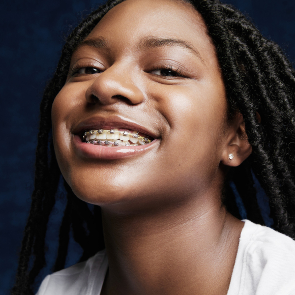 Jordan Orthodontics braces treatment young girl smiling with metal braces